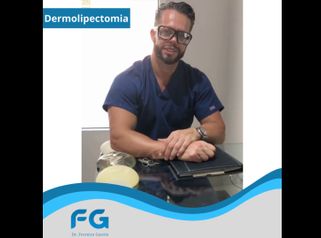 Dermolipectomía - Dr. Gastón Eduardo Ferreira