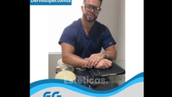 Dermolipectomía - Dr. Gastón Eduardo Ferreira