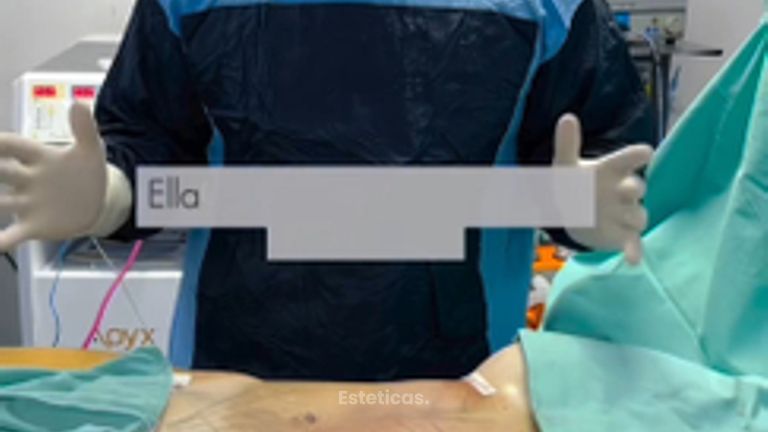 Liposucción - Dr. Cristian Gänsslen