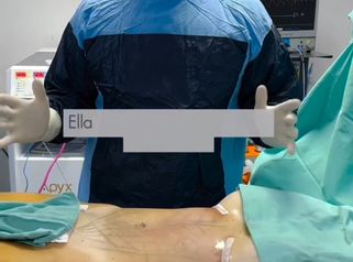 Liposucción - Dr. Cristian Gänsslen