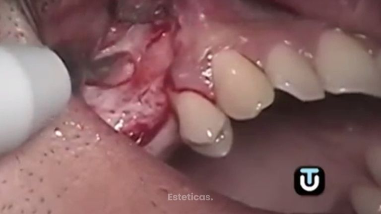 Consigue acabar con los problemas dentales