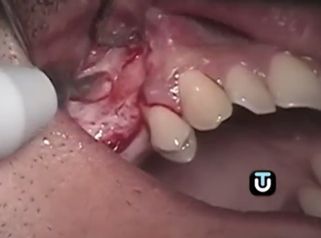Consigue acabar con los problemas dentales