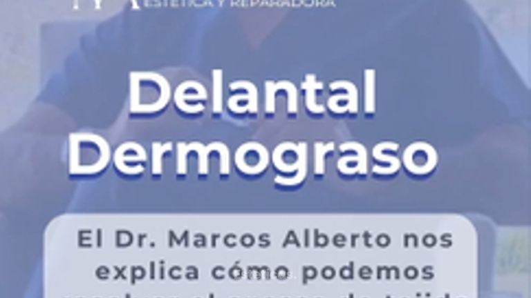 Liposucción - Dr. Marcos F. Alberto