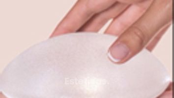 ¿Cada cuánto tiempo se cambian los implantes mamarios? - Dr. Damián Wengrowicz