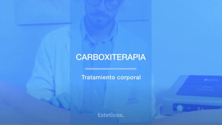 Carboxiterapia - Dr. Mateo Castro Béduchaud