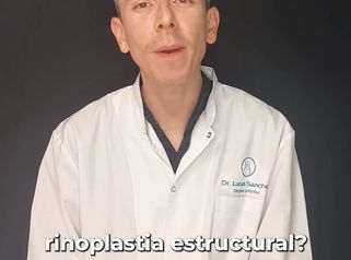 Rinoplastia - Dr. Lucas Sánchez