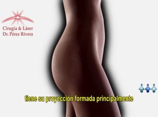 Prótesis de Glúteos - Gluteoplastía