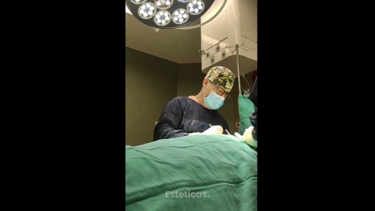 Abdominoplastia - Dr. Matías Llabres