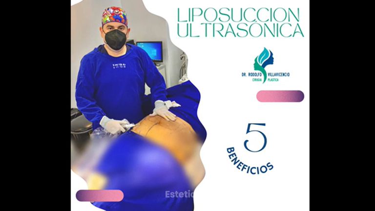 Liposucción - Dr. Rodolfo Villavicencio