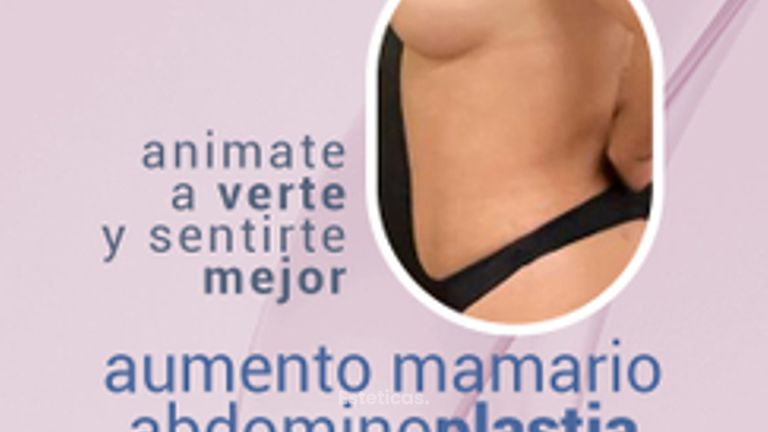 Abdomen + aumento mamario - Dr. Emmanuel Manavela Chiapero