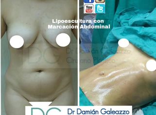 Dr. Damián Galeazzo