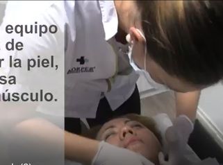 Lifting sin Cirugia