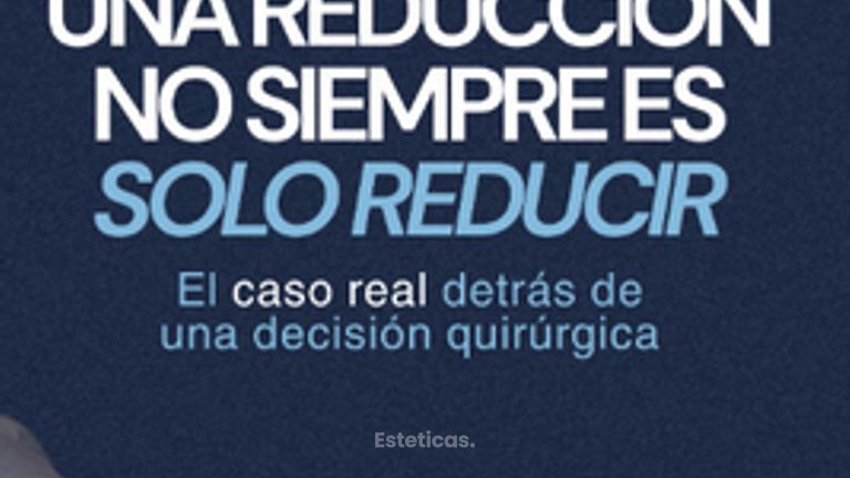 Una reducción no siempre es solo reducir - Dr. Maximiliano Gil Miranda