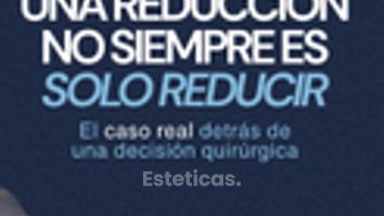 Una reducción no siempre es solo reducir - Dr. Maximiliano Gil Miranda