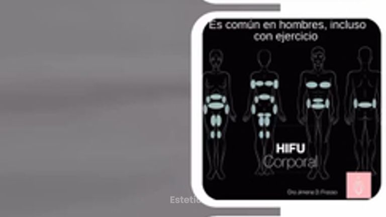 HIFU corporal para hombres - Dra. Jimena D. Frasso