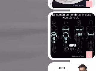 HIFU corporal para hombres - Dra. Jimena D. Frasso
