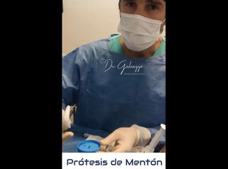 Prótesis mentón - Dr. Damián Galeazzo y Equipo