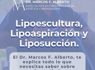 Lipoescultura - Dr. Marcos F. Alberto