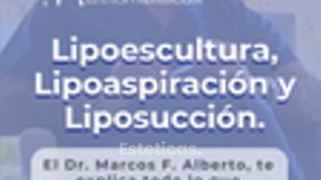 Lipoescultura - Dr. Marcos F. Alberto