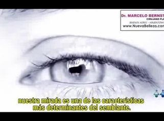 Blefaroplastia