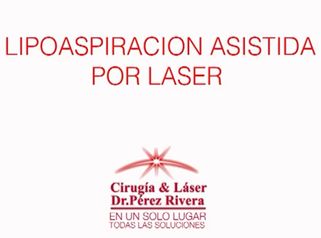 Lipoaspiración asistida por láser