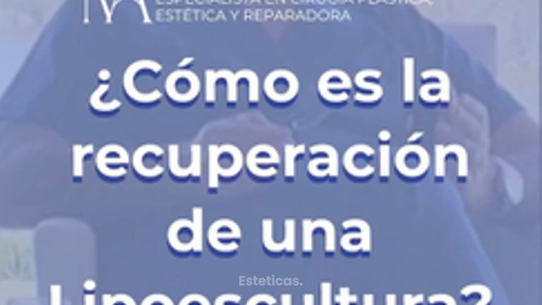 Recuperación de una lipoescultura - Dr. Marcos F. Alberto