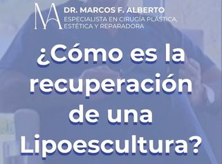 Recuperación de una lipoescultura - Dr. Marcos F. Alberto