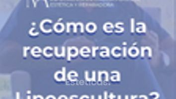 Recuperación de una lipoescultura - Dr. Marcos F. Alberto