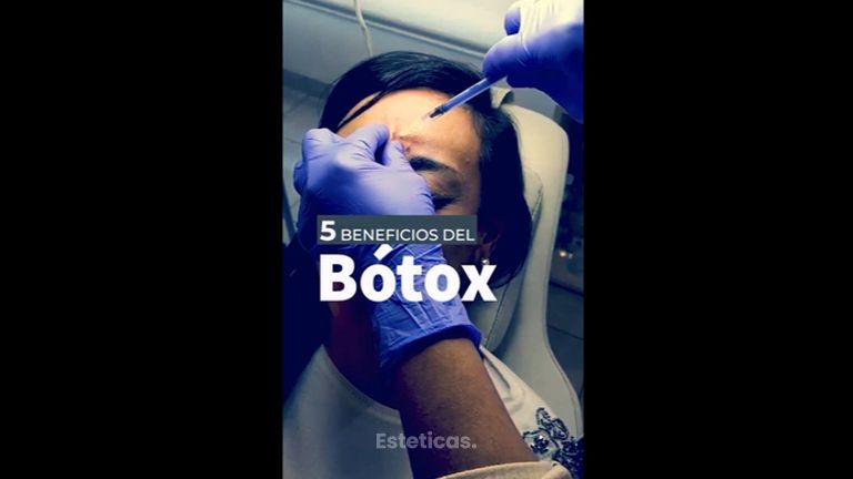 Toxina botulínica - Dra. Torrijos Noelia