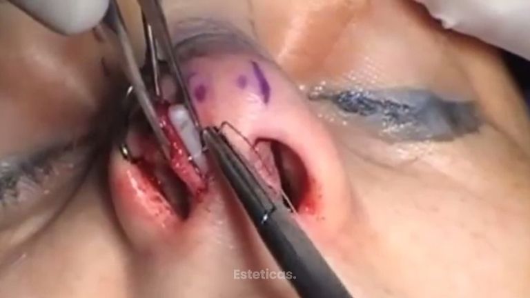 Consigue una gran funcionalidad y estética en tu nariz
