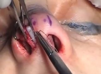 Consigue una gran funcionalidad y estética en tu nariz