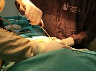 Liposucción - Dr. Javier Nicolía - Centro Médico Palmares