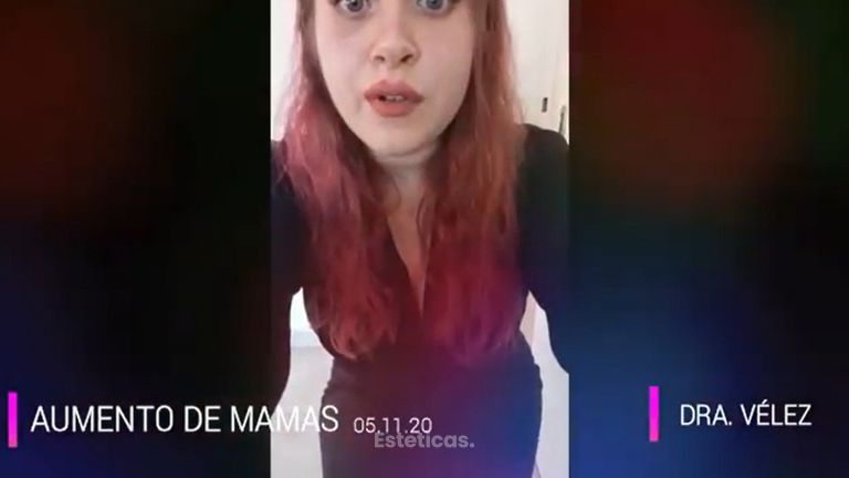 Aumento mamas - Dra. María de la Paz Vélez