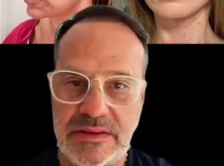 Lifting Facial - Dr.Matias Llabres
