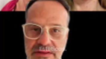 Lifting Facial - Dr.Matias Llabres