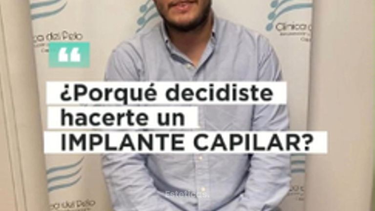 Implante capilar Pelo por Pelo - Dr. Damian Galeazzo y Equipo