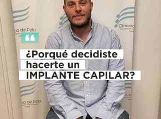 Implante capilar Pelo por Pelo - Dr. Damian Galeazzo y Equipo
