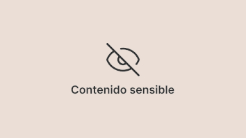 Otoplastia sin cirugia - Dra. María de la Paz Vélez