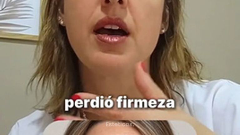¿Perdió firmeza tu cara? - Medvital