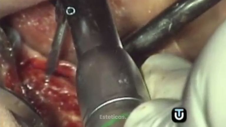 Consigue la dentadura perfecta