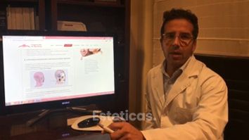 Cirugia de Bichectomia - Dr. Perz Rivera