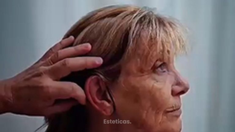 Lifting - Dr. Matias Llabres