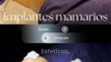Aumento mamarios