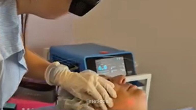 Endolifting - Medvital