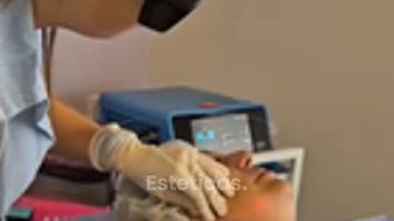 Endolifting - Medvital