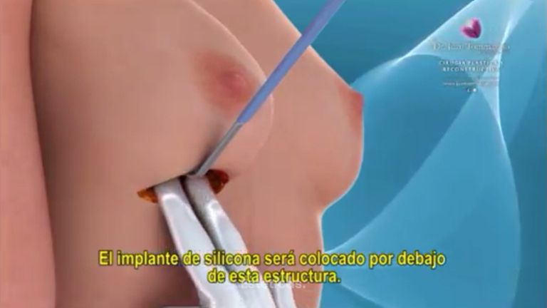 Consigue las mamas más atractivas