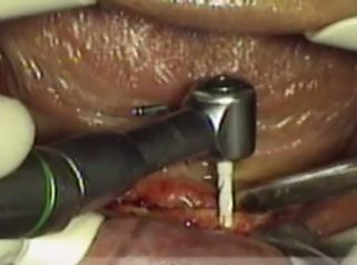 Soluciona tus problemas en los dientes