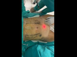 Dr. Carlos Arce - Centro de Cirugía Plástica y Medicina Estética