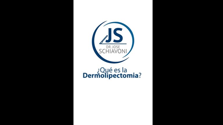 Dermolipectomía - Dr. José María Schiavoni