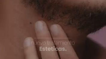 Rellenos Faciales - Dra. Jimena D. Frasso